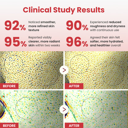 Hypochlorous Acid Rice Duo For Face & Body | Gentle Exfoliating Serum for Dead Skin Cells & Pore Care, Blackheads & Excess Sebum Control | Rice Extract, Hypochlorous, Panthenol for Hydrating & Smoothing Care