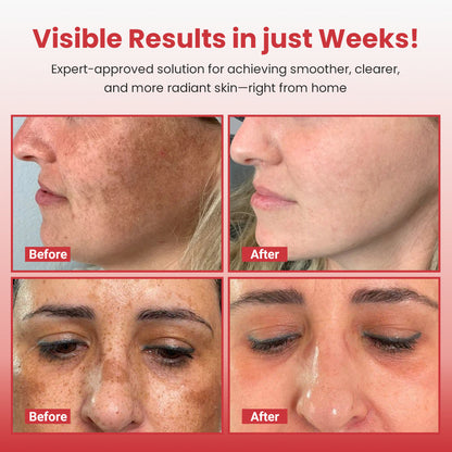 Hypochlorous Acid Rice Duo For Face & Body | Gentle Exfoliating Serum for Dead Skin Cells & Pore Care, Blackheads & Excess Sebum Control | Rice Extract, Hypochlorous, Panthenol for Hydrating & Smoothing Care